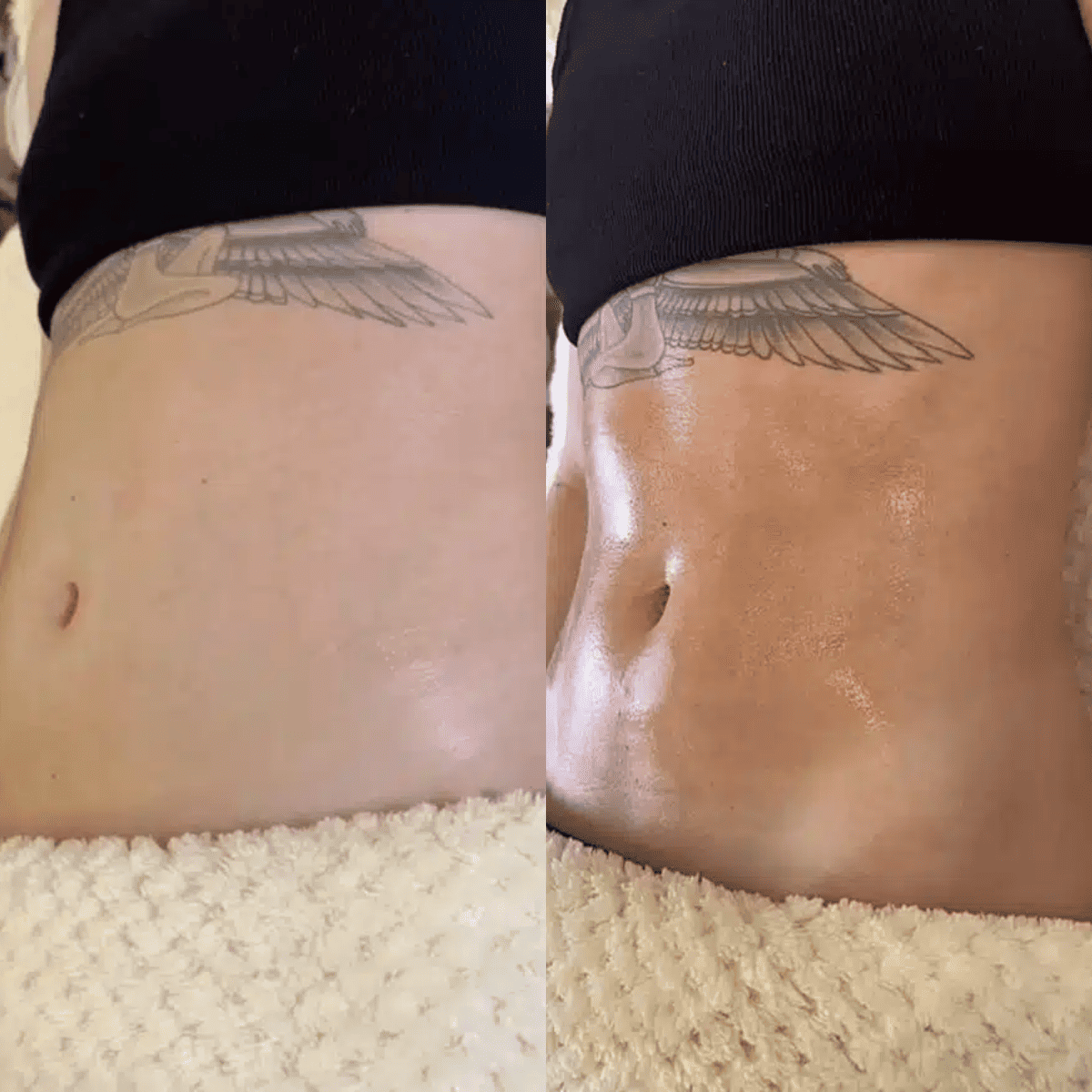 antes e depois drenagem (1)